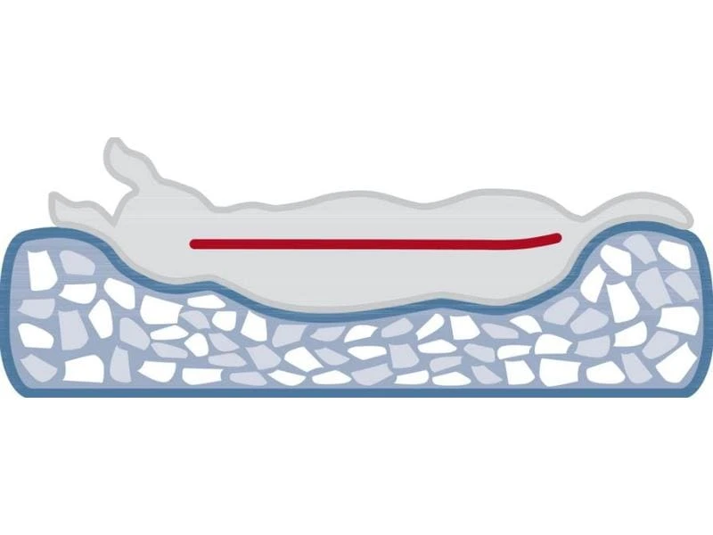 Trixie Hunde-Kissen Vital Calito 70 x 50 cm 4 Trixie Hunde-Kissen Vital Calito 70 x 50 cm – Bild 4